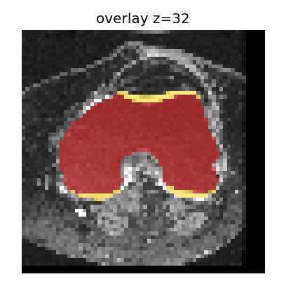 Full segmentation overlay