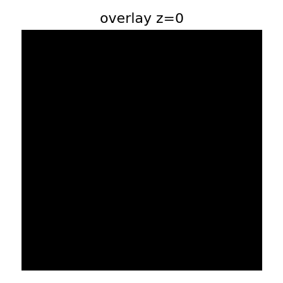 Overlay from a different axial slice